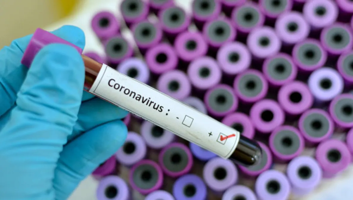 Două noi cazuri de coronavirus în România! Pacienții sunt internați