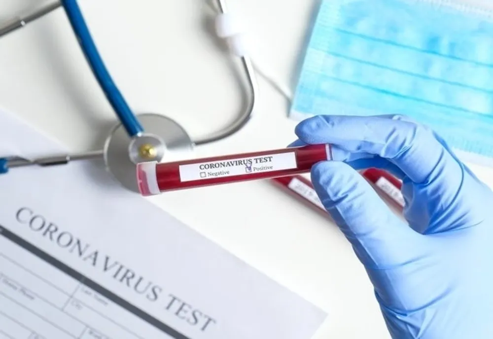 Lovitură pentru un om de afaceri ieșean: A fost confirmat cu coronavirus!
