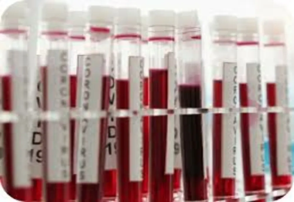 De ce testele de anticorpi nu sunt trecute în certificatul de vaccinare. Explicațiile lui Valeriu Gheorghiță