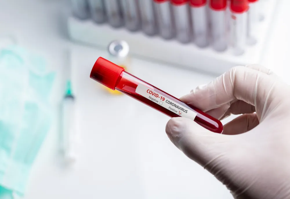 Cazuri noi de coronavirus la Iași. Doi dintre pacienți sunt ieșeni