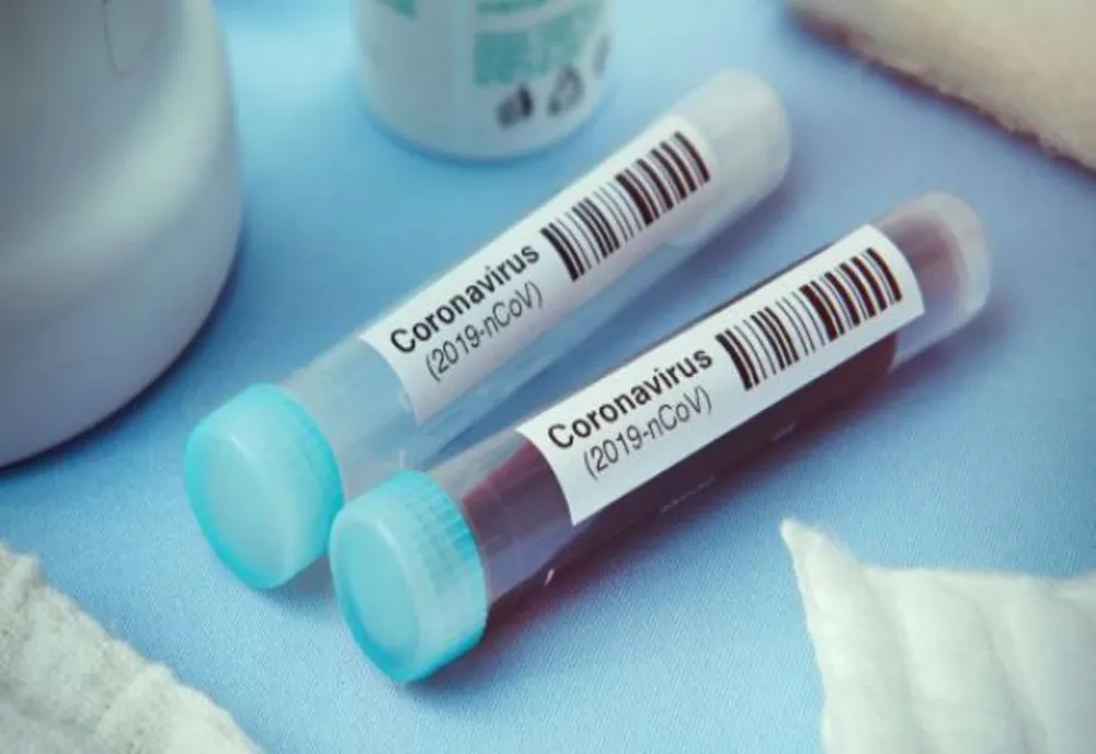 Coronavirus / Primul deces înregistrat pe teritoriul României!