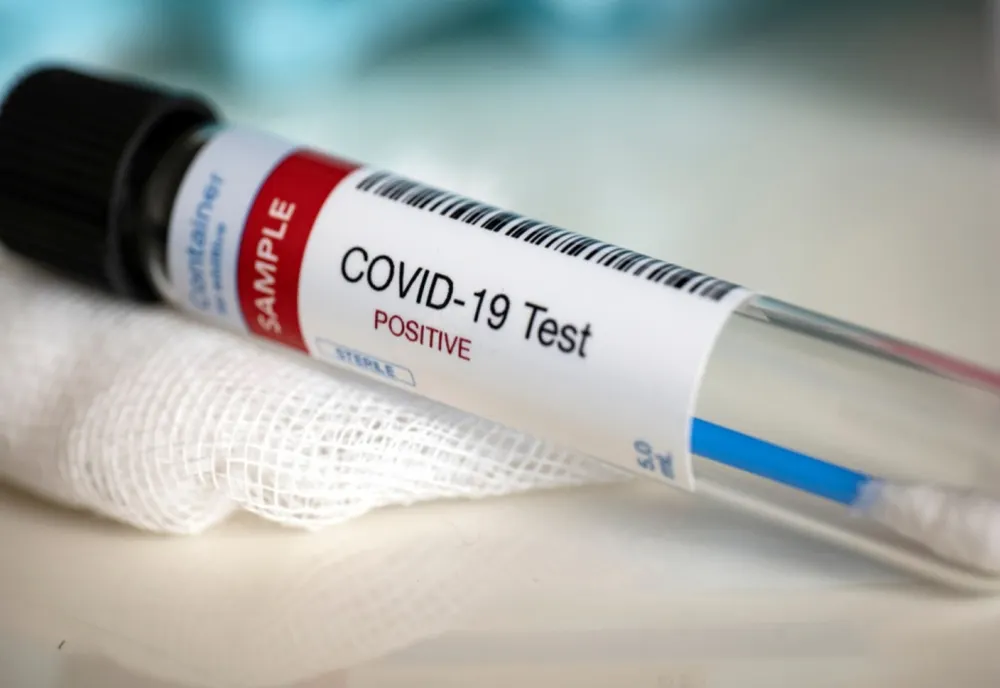 Bilanț coronavirus 13 iulie: 51 de cazuri noi și 4 decese