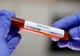 Câte persoane au fost confirmate ca fiind infectate cu coronavirus în Iași