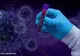 Bilanț coronavirus 17 martie: 6.186 de cazuri noi și 89 de decese