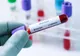 Bilanț coronavirus 18 octombrie: 10.141 cazuri noi de persoane infectate cu COVID în ultimele 24 de ore